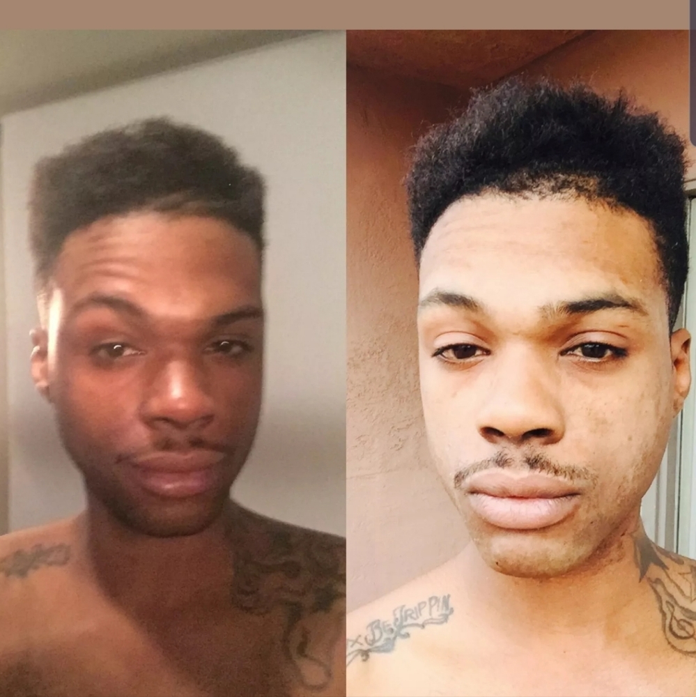 Lightening - Picture 2 of 3